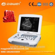 laptop ultrasound scanner & ultrasound dawei
Welcome your enquiry for laptop ultrasound scanner & ultrasound dawei!